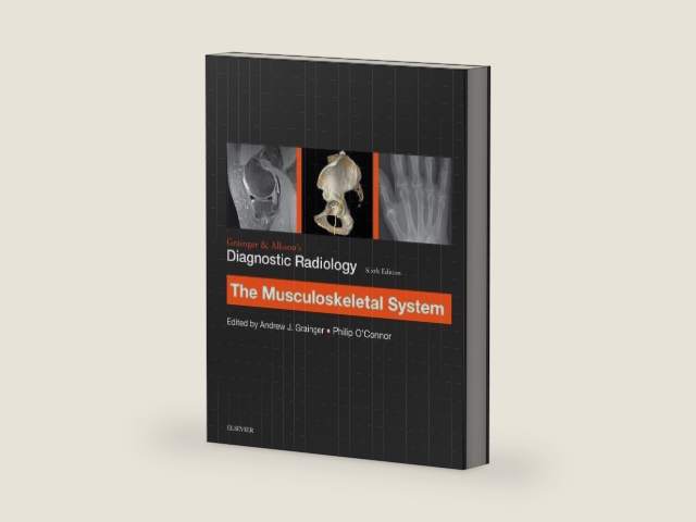 Grainger & Allison’s Diagnostic Radiology: Musculoskeletal System by Andrew Grainger | barcode:9780702069369 | source:'9780702069369-right-three-quarter.jpg