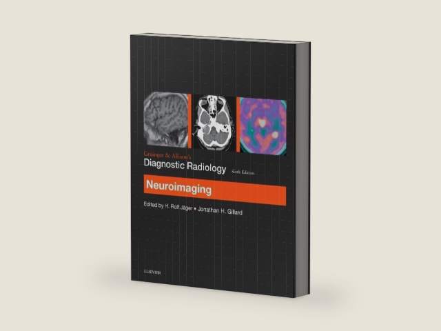 Grainger & Allison’s Diagnostic Radiology: Neuroimaging by H. Rolf Jager FRCR MD | barcode:9780702069376 | source:'9780702069376-right-three-quarter.jpg