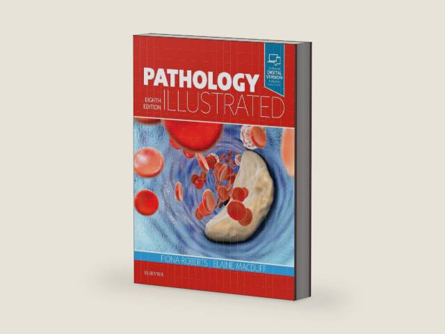Pathology Illustrated by Fiona Roberts BSc MBChB MD FRCPath | barcode:9780702072062 | source:'9780702072062-right-three-quarter.jpg