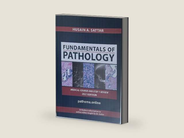 PATHOMA, Fundamentals of Pathology by Dr Hussain A. Satar, International Edition Paperback 2021 by Hussain A.Satar | barcode:9781365764592 | source:'9781365764592-right-three-quarter.jpg