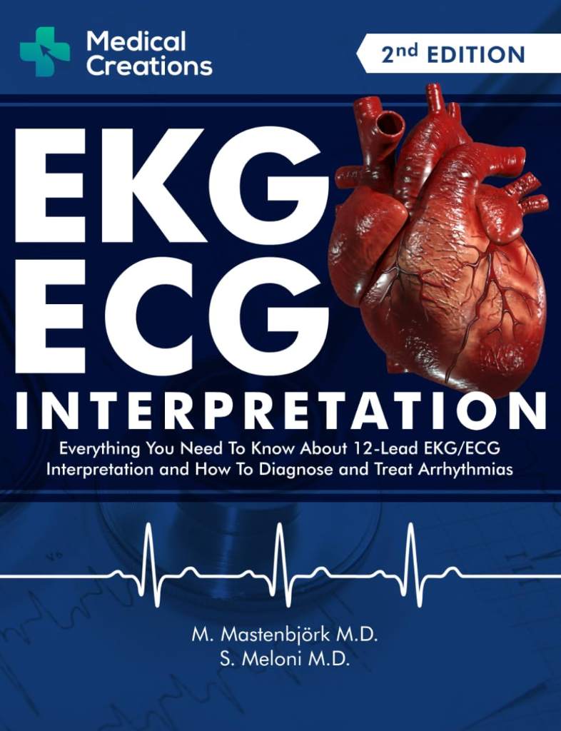 EKG/ECG Interpretation: Everything you Need to Know about the 12 - Lead ECG/EKG Interpretation and How to Diagnose and Treat Arrhythmias by S. Meloni M.D. - 9781734741353