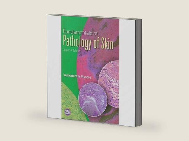 Fundamentals of Pathology of Skin by M.D. Mysore, Venkataram | barcode:9781904798699 | source:'9781904798699-right-three-quarter.jpg