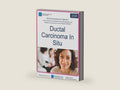 NCCN Guidelines for Patients® Ductal Carcinoma In Situ by National Comprehensive Cancer Network® (NCCN®) | barcode:9781971567341 | source:'9781971567341-right-three-quarter.jpg